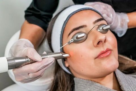 A Complete Guide to Skin Resurfacing Treatments: Essential Facts and Insights